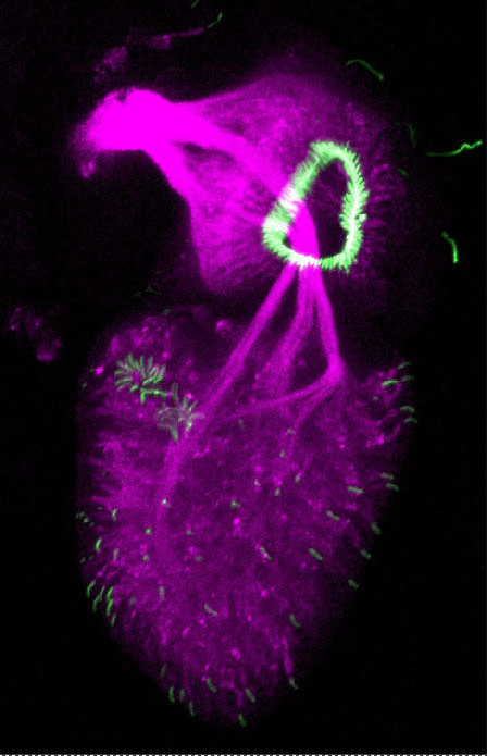 antenna - fluorescent neurons and dendritic caps