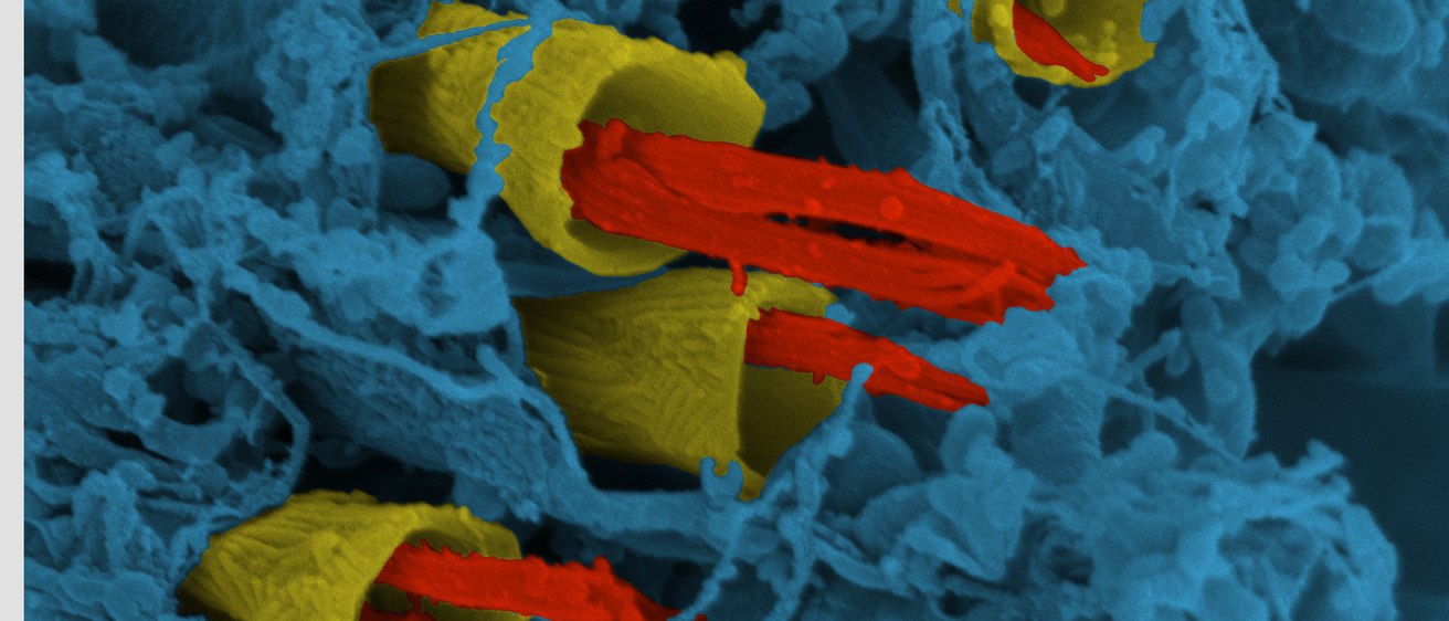 JO cilia connecting to dendritic caps
